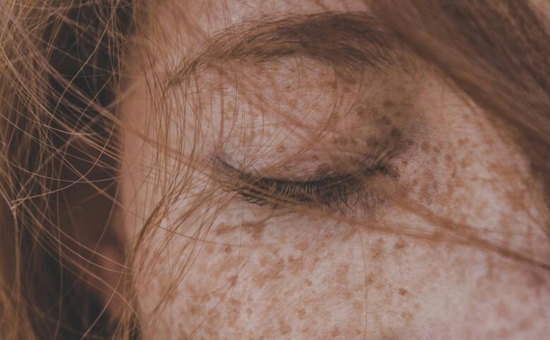 Spolu proti melanomu - vyšetření znamének zdarma